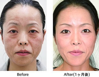 治療前と後の比較写真