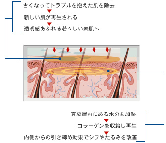 肌の構造図