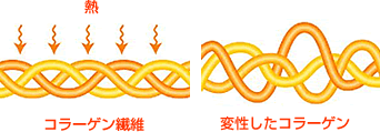 変性したコラーゲンの図