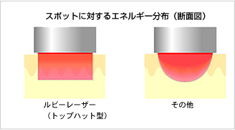 スポットに対するエネルギー分布図