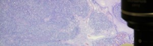 byouri1
